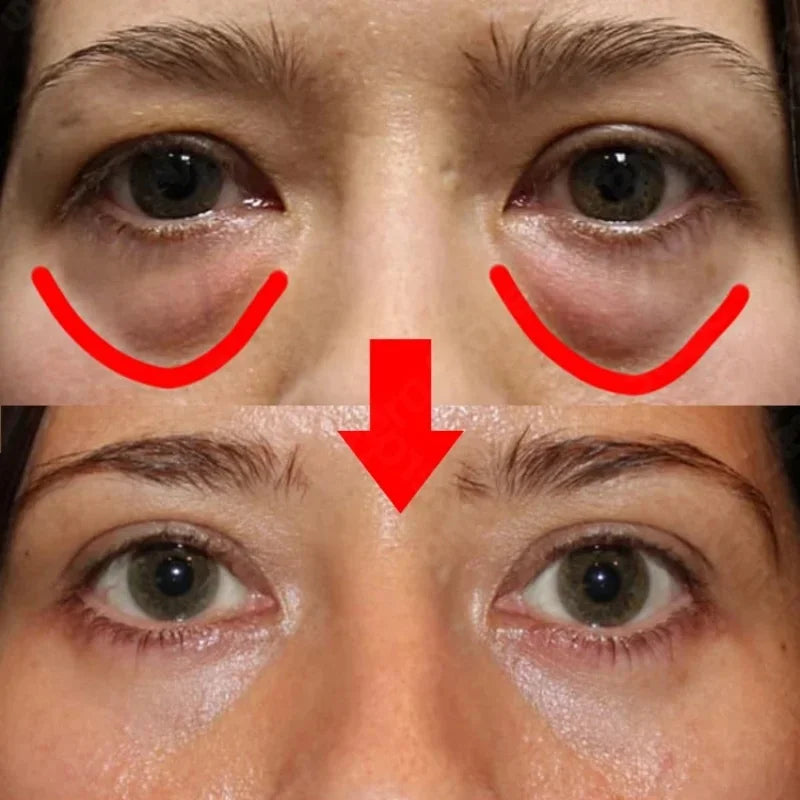 Peptide Anti-Wrinkle Eye Cream Days Remove Puffiness