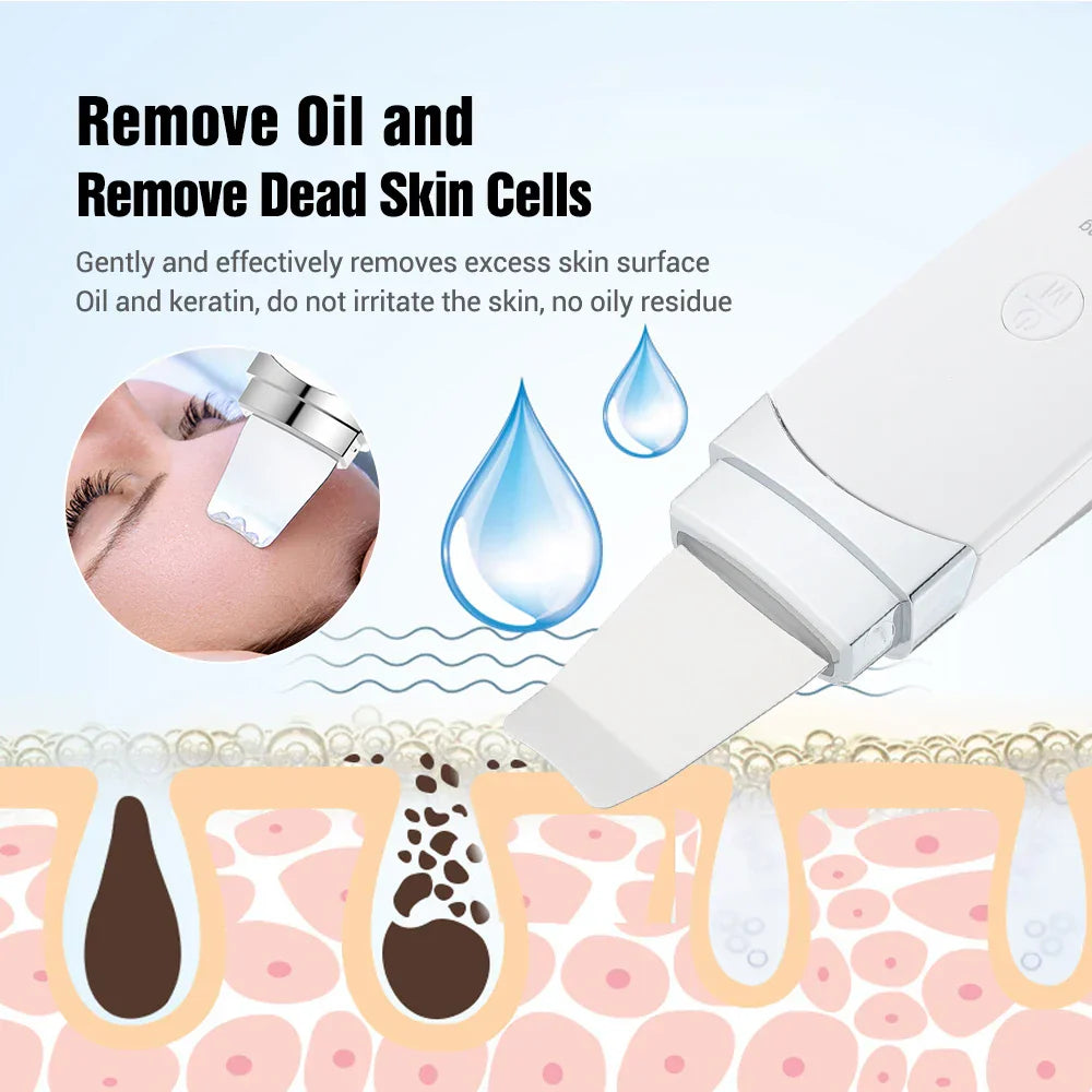 Ultrasonic Skin Scrubber Face Vibration Spatula Blackhead Remover