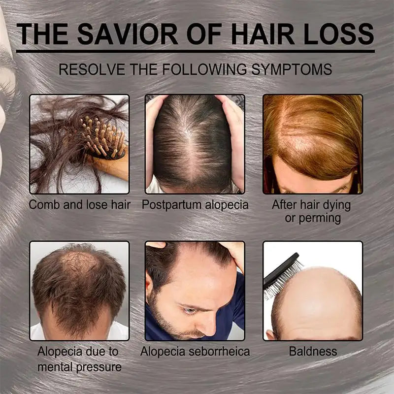 Rosemary Oil For Hair Growth Anti Hairs Loss