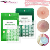 Mm Acne Pimple Patch Stickers Waterproof Acne Treatment