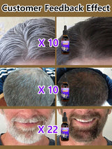 Gray White Hair Treatment Serum Liquid White