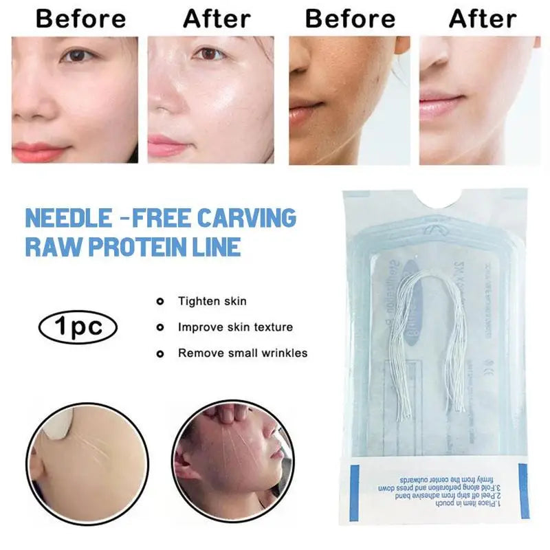 Absorbable No Needle Gold Protein Line Anti-Wrinkle