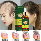 Days Ginger Hair Growth Products Fast Promote Hair