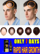 Best-Selling Hair Growth Products, Anti-Hair Loss Hair Growth