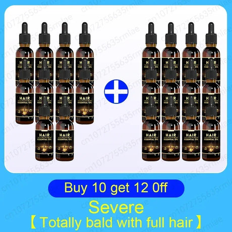 Best-Selling Hair Growth Products, Anti-Hair Loss Hair Growth