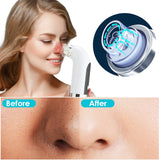 Blackhead Remover Pore Cleaner Vacuum Suction Acne Remover