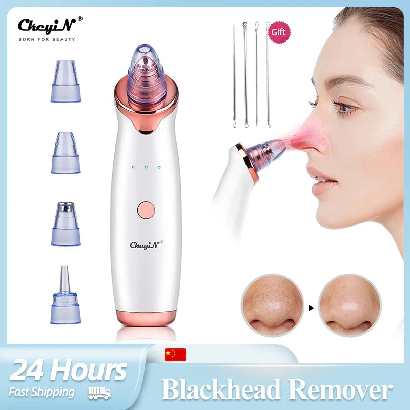 Ckeyin Electric Blackhead Remover Vacuum Facial Acne Cleaner