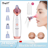 Ckeyin Electric Blackhead Remover Vacuum Facial Acne Cleaner