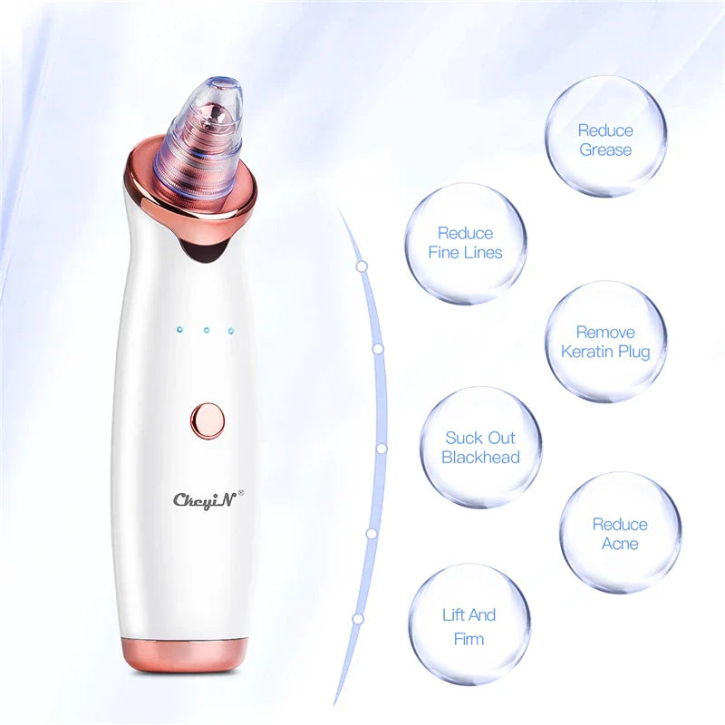 Ckeyin Electric Blackhead Remover Vacuum Facial Acne Cleaner