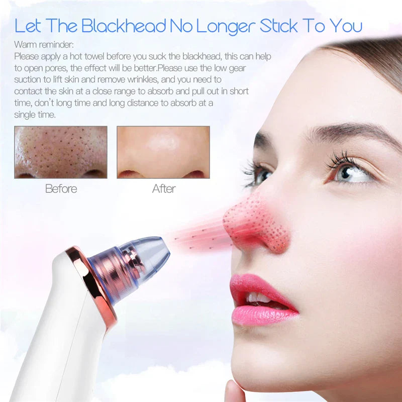 Ckeyin Electric Blackhead Remover Vacuum Facial Acne Cleaner