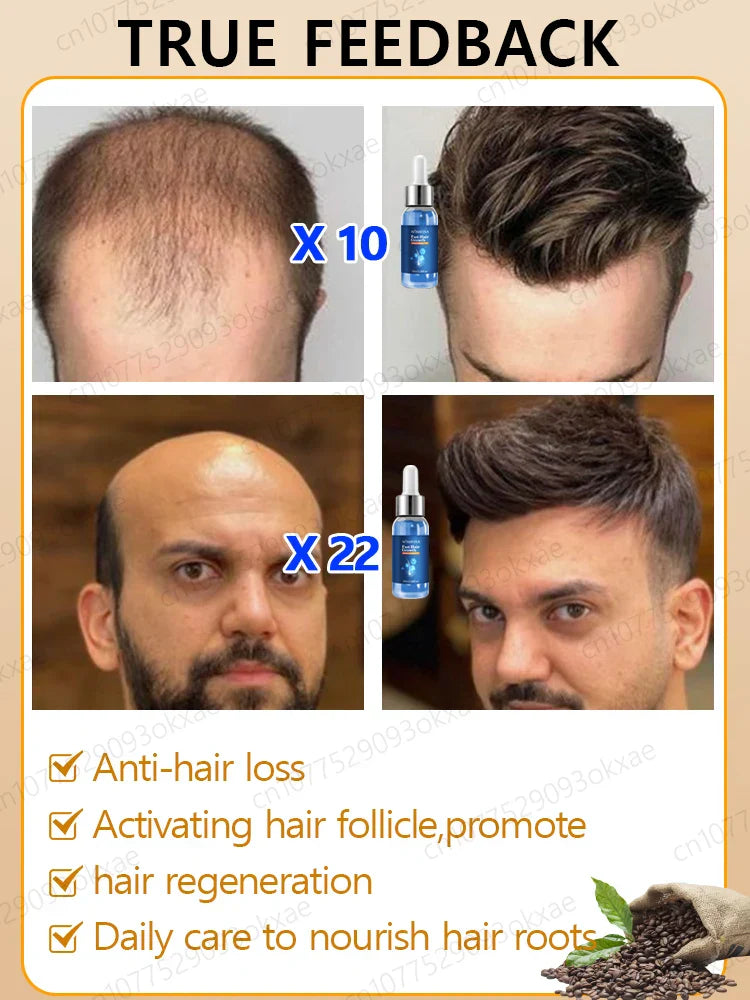 Fast Hair Growth Essence Oil Products Effective Baldness