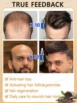 Fast Hair Growth Essence Oil Products Effective Baldness