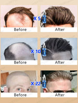 Fast Hair Growth Essence Oil Products Effective Baldness