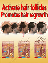 Fast Hair Growth Oil For Men Treatment