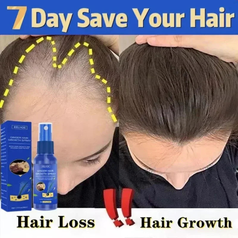 Hair Growth Spray Promote Fast Thicker Longer Ginger