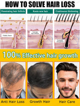 Hair Growth Oil, Rapid Hair Growth, Effective Repair