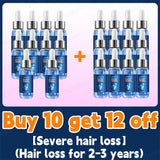 Hair Growth Products Fast Hair Growth Hair Growth