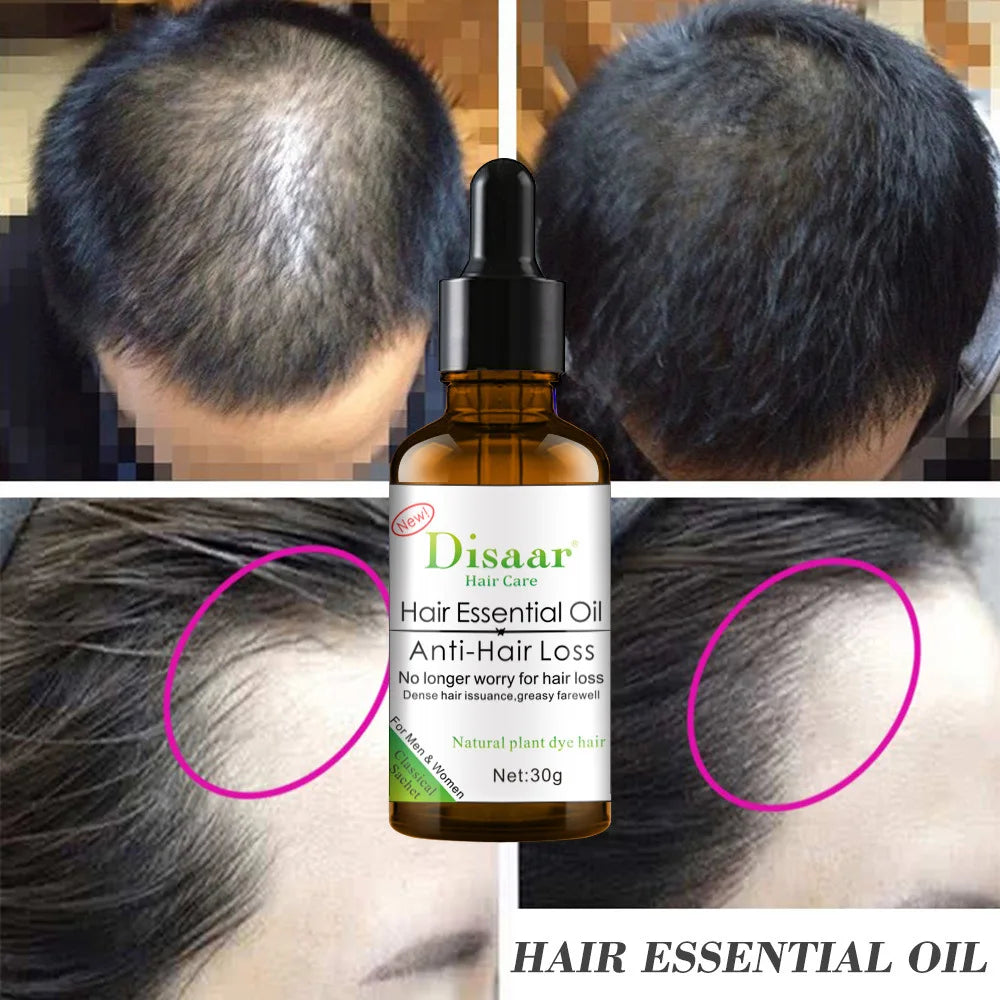 Disaar Hair Essential Oil Helps Regrowth Prevent