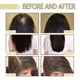 Natural Hair Growth Oil Efficient Anti Hair Loss