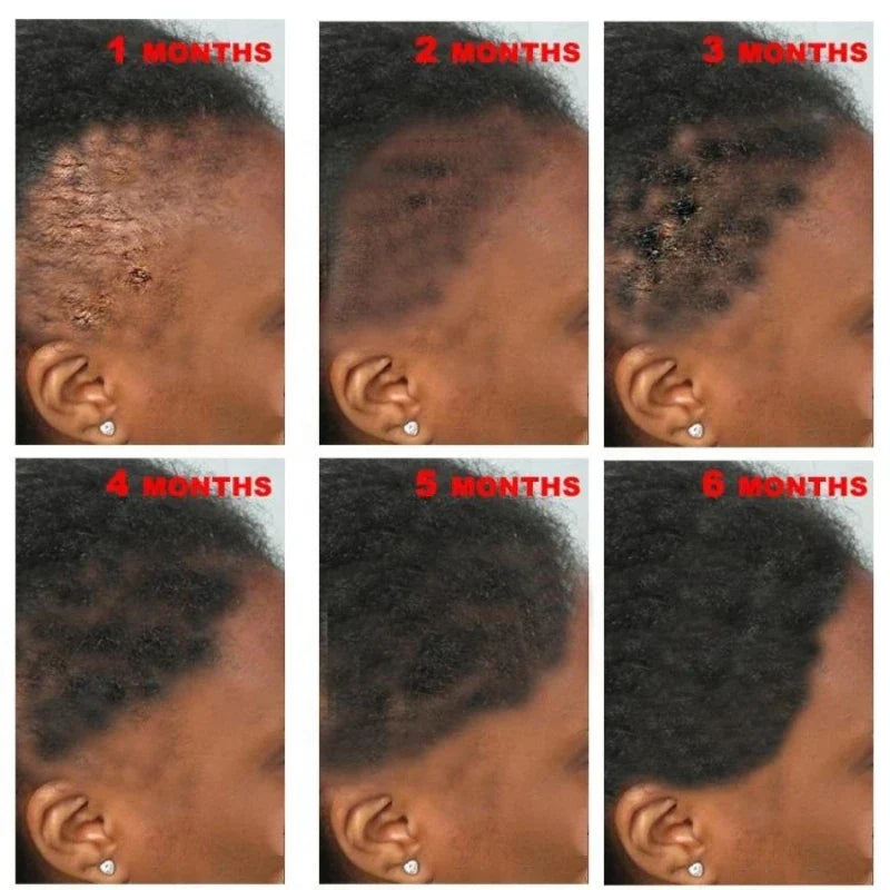 New Fast Hair Growth Serum % African Crazy