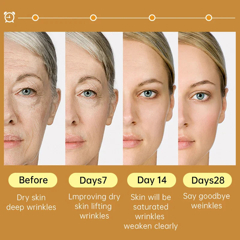 Niacinamide Serum Hyaluronic Acid For Face Dark Spot