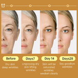 Niacinamide Serum Hyaluronic Acid For Face Dark Spot