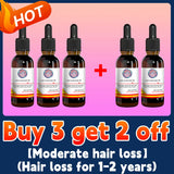 Oil Hair Growth Products For Man Women Ginger