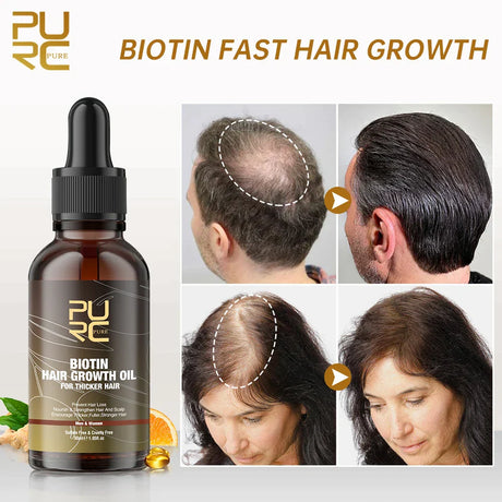 Purc Fast Hair Growth Products For Men Biotin