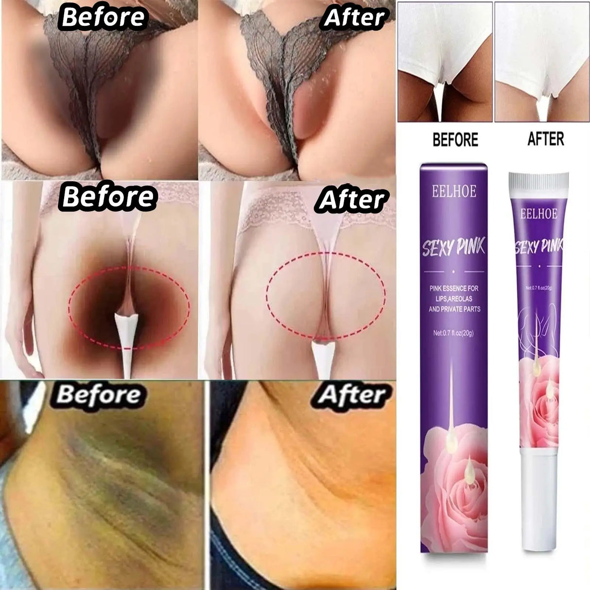 Private Body Whitening Cream Armpit Buttock Nipple Private