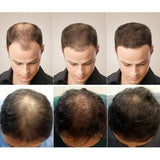 Ginger Hair Growth Soap Anti Hair Loss Fast