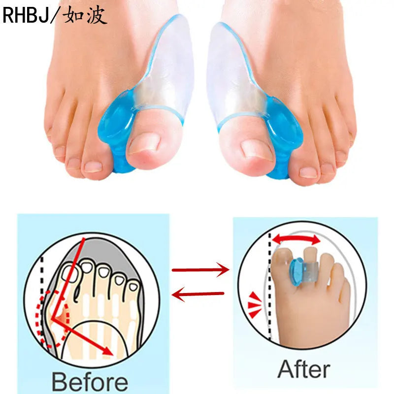 Silicone Gel Thumb Corrector Bunion Foot Toe Hallux