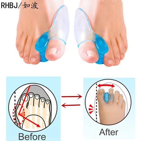 Silicone Gel Thumb Corrector Bunion Foot Toe Hallux