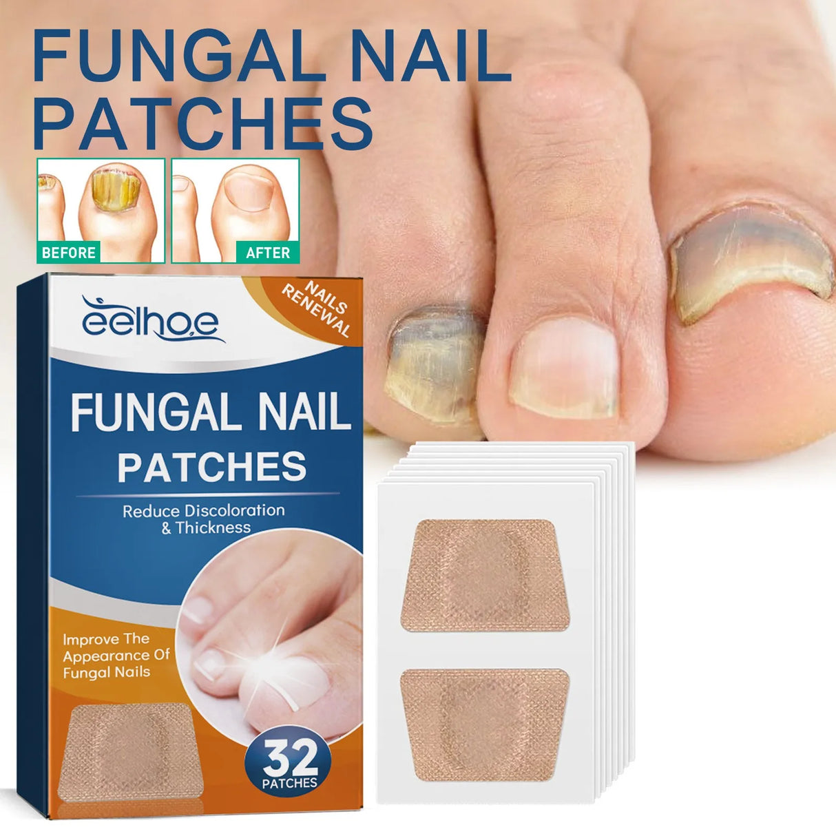 Paronychia Treatment Patch Fungus Removal Nail Ingrown