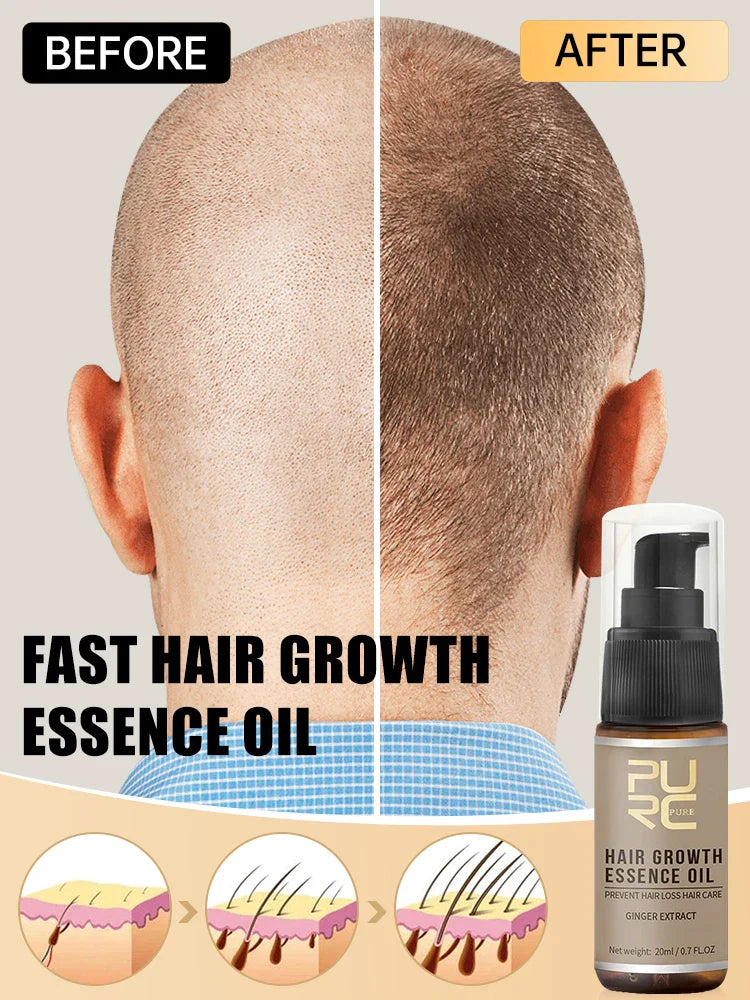 Purc Hair Growth Oil For Men Women Anti