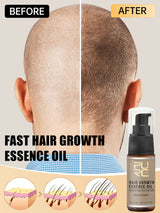 Purc Hair Growth Oil For Men Women Anti