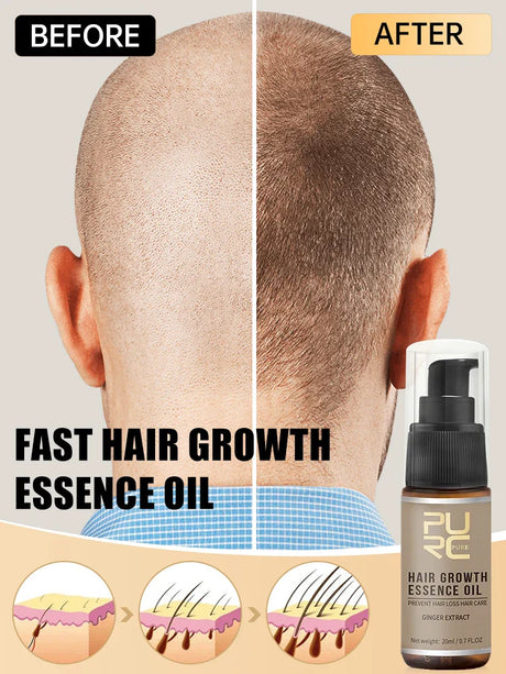 Purc Hair Growth Oil For Men Women Anti