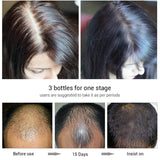 Biotin Fast Hair Growth Products Anti Hair Loss