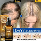 Biotin Fast Hair Growth Products Anti Hair Loss