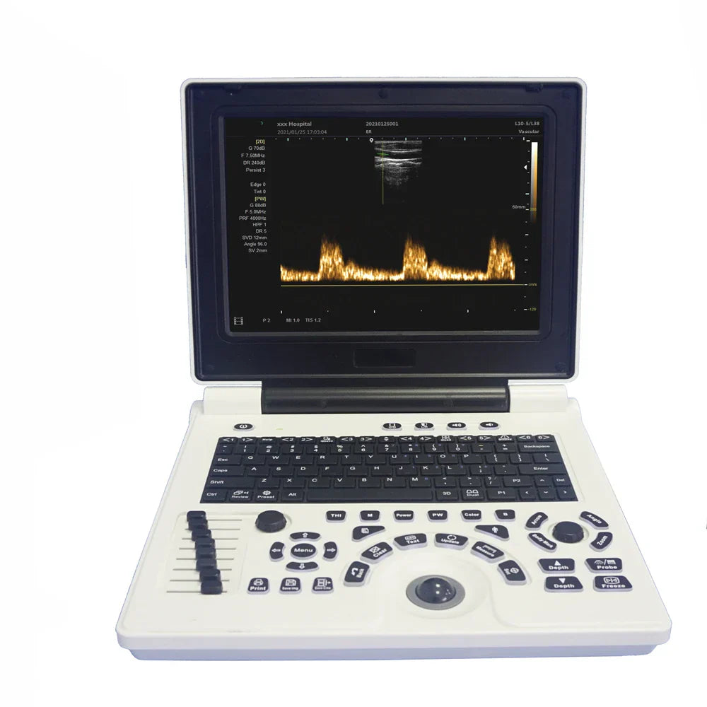 D Based Notebook Black White Ultrasound Scanner Pw