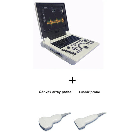 D Based Notebook Black White Ultrasound Scanner Pw