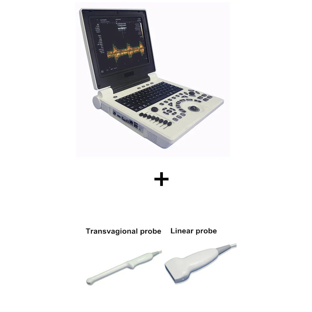 D Based Notebook Black White Ultrasound Scanner Pw