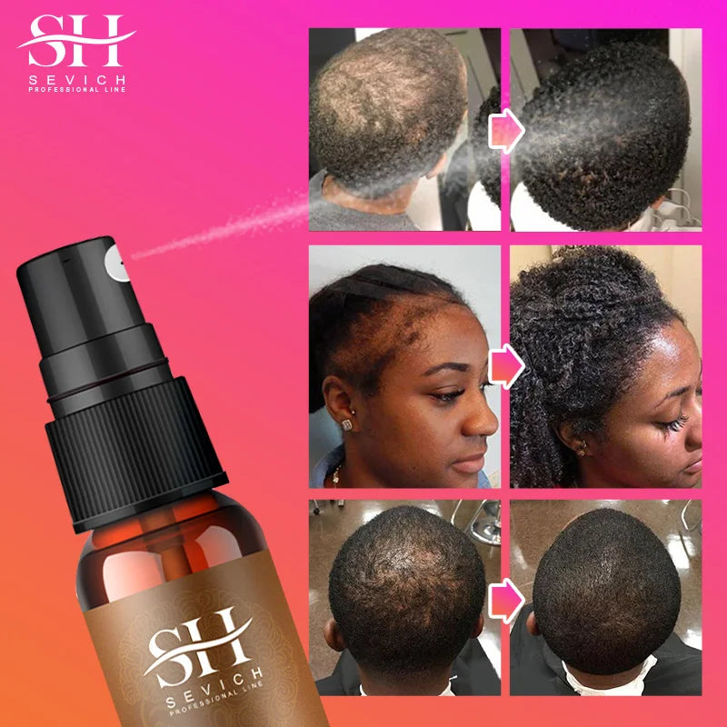 Fast Hair Growth Set Traction Alopecia Styling Braiding