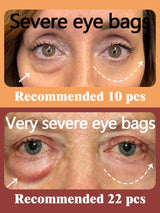 Avocado Eye Essence Cream Remove Eye Bags Dark