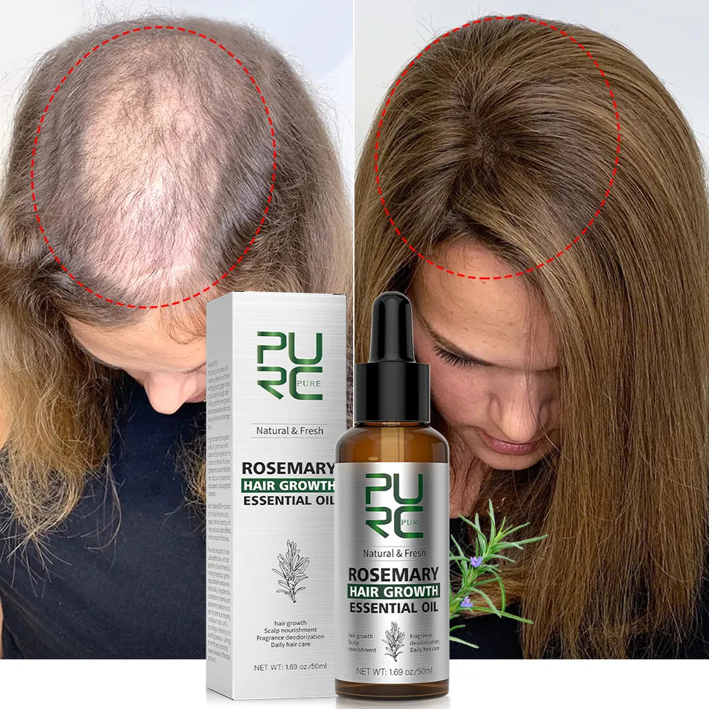 Purc Rosemary Oil Hair Growth For Men Women