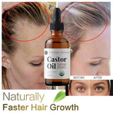 Castor Oil Prevents Hair Loss Stimulate Eyelashes Eyebrows