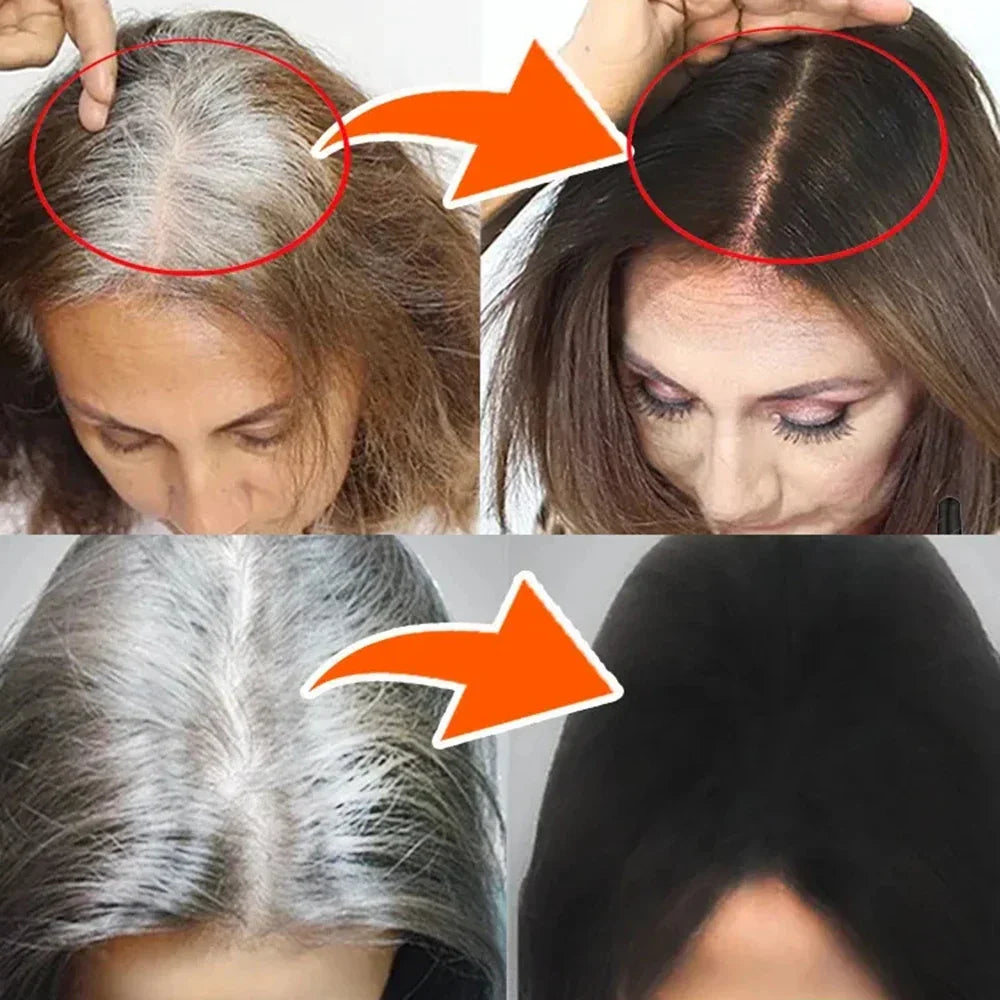 Gray White Hair Treatment Serum Oil White