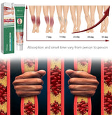 Varicose Vein Treatments Cream Effective Relieve Legs Dilated