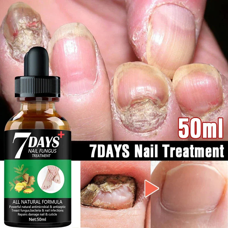 Days Repair Nail Fungus Treatments Essence Foot Care