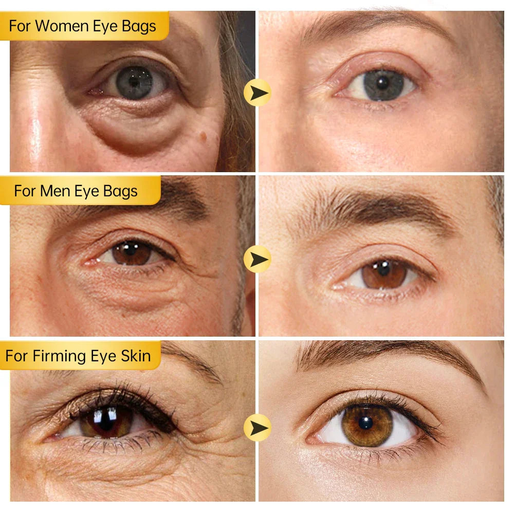 Eye Cream Eye Bags Removal Under