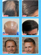 Hair Growth Essence Can Quickly Grow Hair
